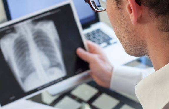 covid-19-sonrasi-cikan-hastaliklar