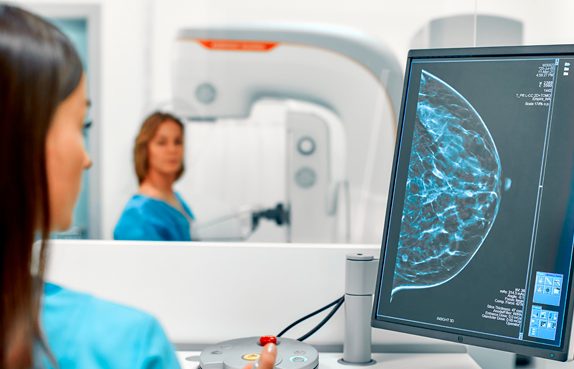 dijital-mamografi-avantajlari