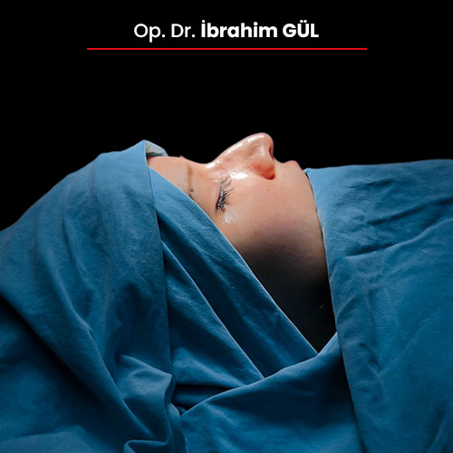 02oncesi_ibrahimgul_13032024 02oncesi_ibrahimgul_13032024