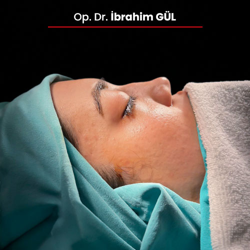 03oncesi_ibrahimgul_13032024 03oncesi_ibrahimgul_13032024