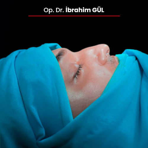 04oncesi_ibrahimgul_13032024 04oncesi_ibrahimgul_13032024