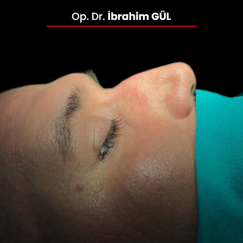 07oncesi_ibrahimgul_13032024 07oncesi_ibrahimgul_13032024