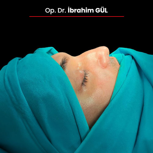 08oncesi_ibrahimgul_13032024 08oncesi_ibrahimgul_13032024