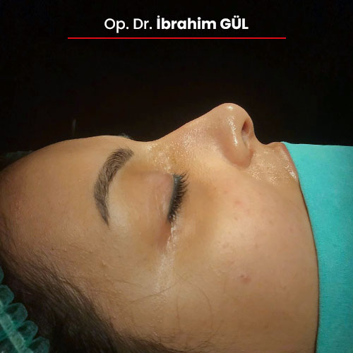 09oncesi_ibrahimgul_13032024 09oncesi_ibrahimgul_13032024
