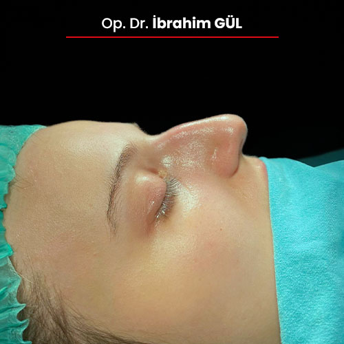 10oncesi_ibrahimgul_13032024 10oncesi_ibrahimgul_13032024