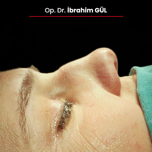 11oncesi_ibrahimgul_13032024 11oncesi_ibrahimgul_13032024