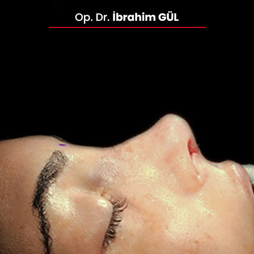12sonrasi_ibrahimgul_13032024 12sonrasi_ibrahimgul_13032024