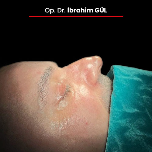 13oncesi_ibrahimgul_13032024 13oncesi_ibrahimgul_13032024