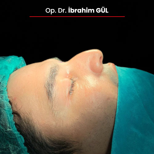 14oncesi_ibrahimgul_13032024 14oncesi_ibrahimgul_13032024