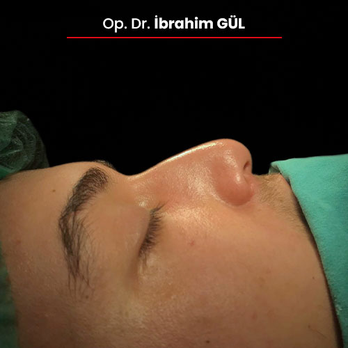 15oncesi_ibrahimgul_13032024 15oncesi_ibrahimgul_13032024