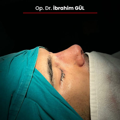 16oncesi_ibrahimgul_13032024 16oncesi_ibrahimgul_13032024