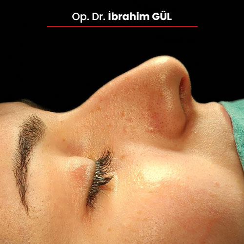 17oncesi_ibrahimgul_13032024 17oncesi_ibrahimgul_13032024