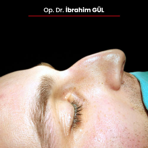 19oncesi_ibrahimgul_13032024 kopya 19oncesi_ibrahimgul_13032024 kopya