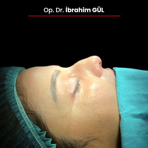 19oncesi_ibrahimgul_13032024 19oncesi_ibrahimgul_13032024