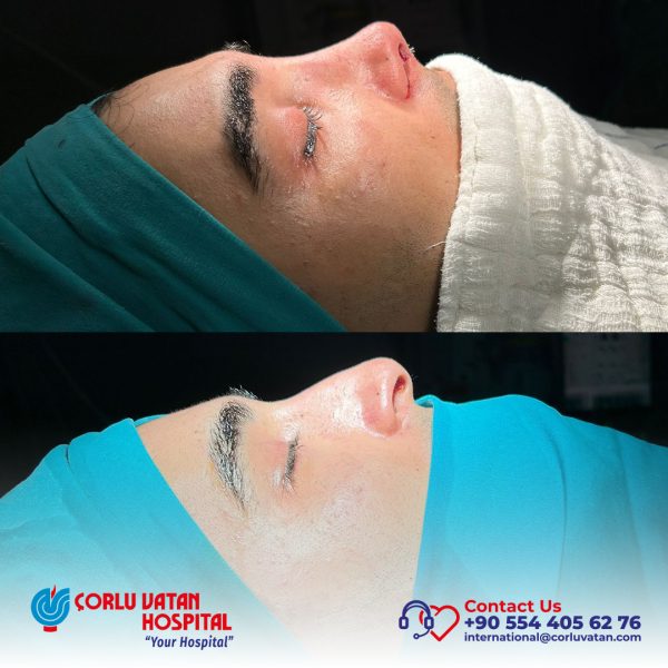 bfÇalışma yüzeyi 1