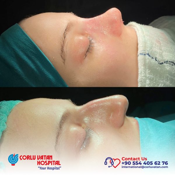 bfÇalışma yüzeyi 1 kopya 10