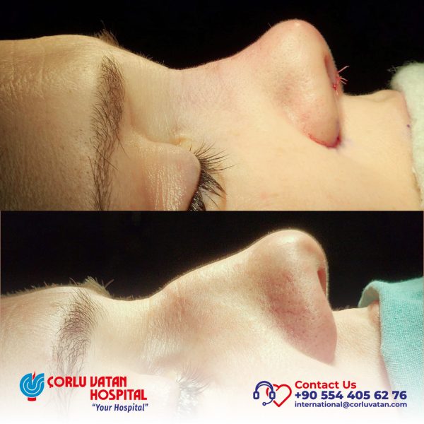 bfÇalışma yüzeyi 1 kopya 11