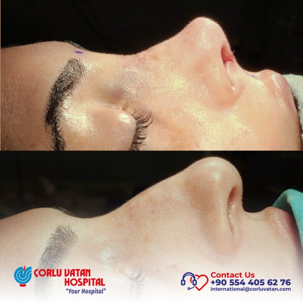 bfÇalışma yüzeyi 1 kopya 12