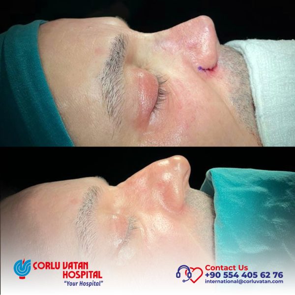 bfÇalışma yüzeyi 1 kopya 13