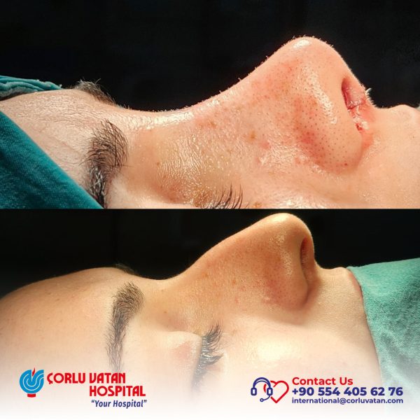 bfÇalışma yüzeyi 1 kopya 17