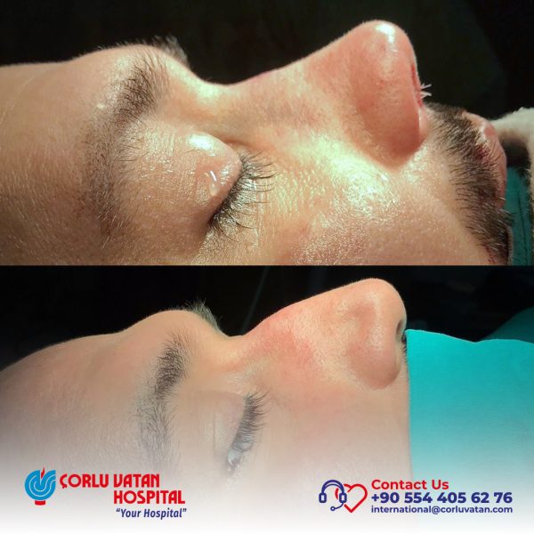 bfÇalışma yüzeyi 1 kopya 18