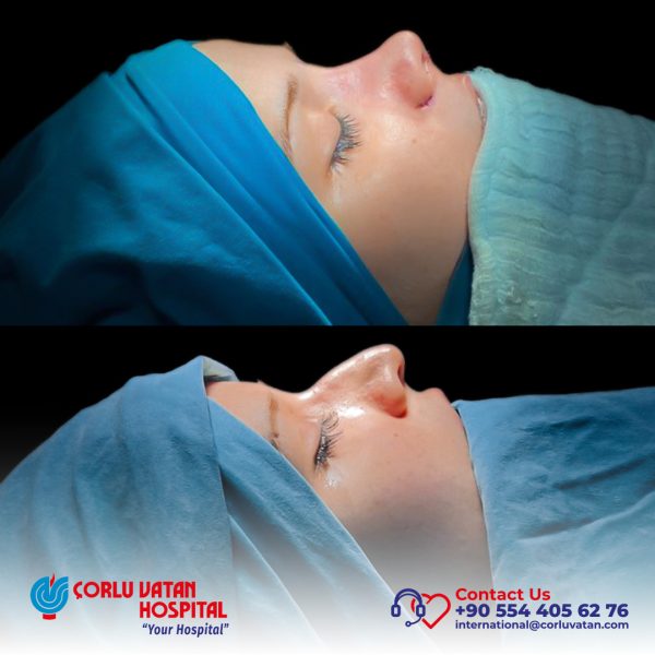 bfÇalışma yüzeyi 1 kopya 2