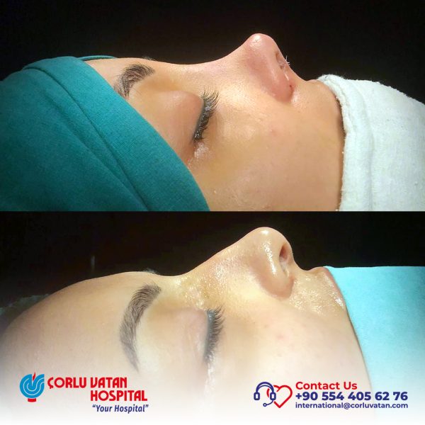 bfÇalışma yüzeyi 1 kopya 20