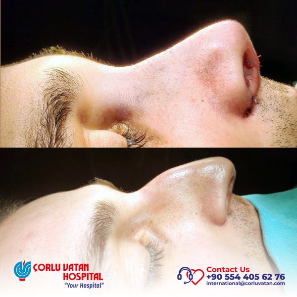 bfÇalışma yüzeyi 1 kopya 21