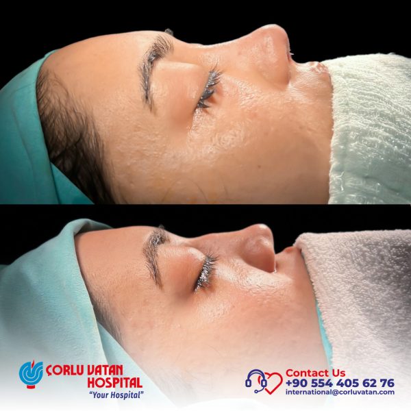 bfÇalışma yüzeyi 1 kopya 3