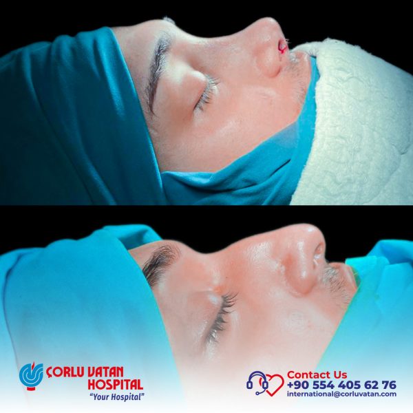 bfÇalışma yüzeyi 1 kopya 4