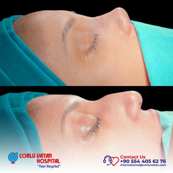 bfÇalışma yüzeyi 1 kopya 5