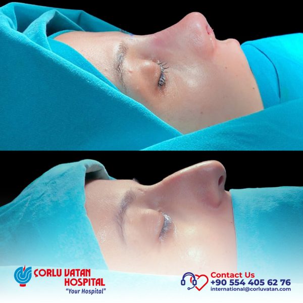 bfÇalışma yüzeyi 1 kopya 6