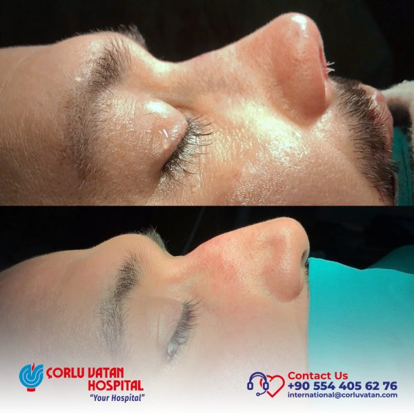 bfÇalışma yüzeyi 1 kopya 7