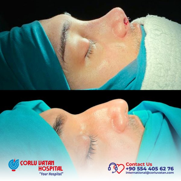 bfÇalışma yüzeyi 1 kopya 8