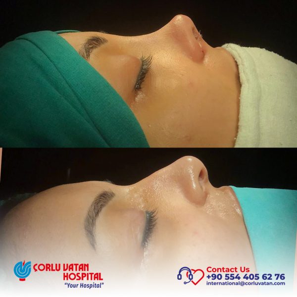 bfÇalışma yüzeyi 1 kopya 9