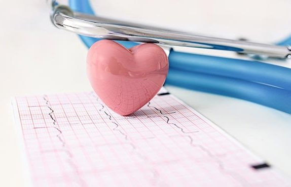 ekg-23-03-2024-kapak