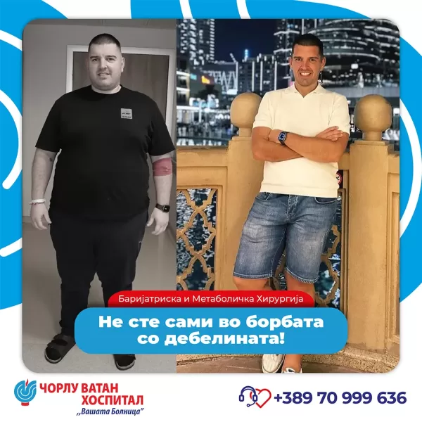 001_obezitemikrositesi_05062024mk-6