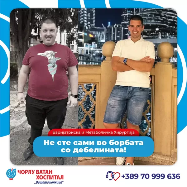 01_obezitemikrositesi_05062024mk-6