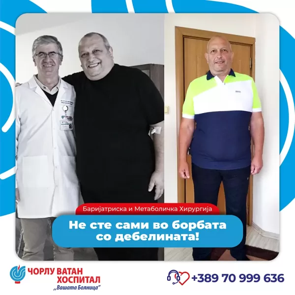 21_obezitemikrositesi_05062024mk-6