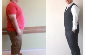 gorsel-12-botox-gastric15072024 gorsel-12-botox-gastric15072024