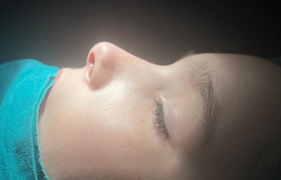 nazal-fraktur-hasta-haberi30122024