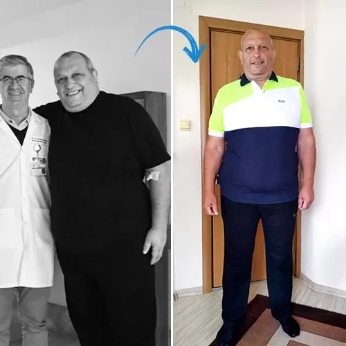 before-after-206052025