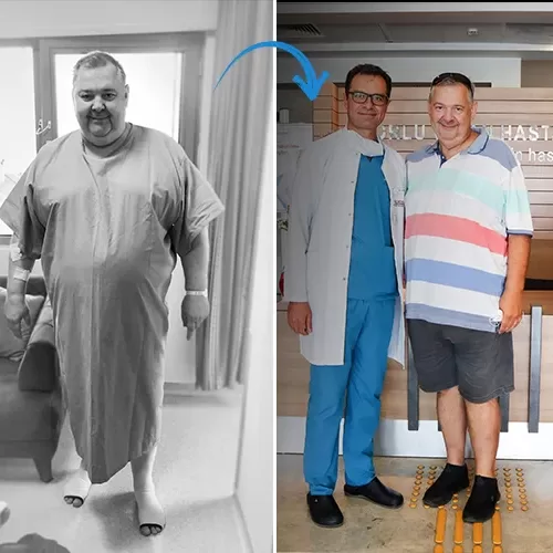 before-after06052025