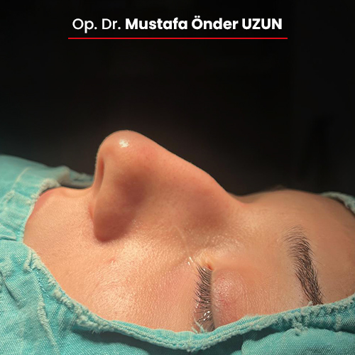 1-oncesi-01092025 1-oncesi-01092025