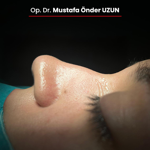 2-oncesi-01092025 2-oncesi-01092025
