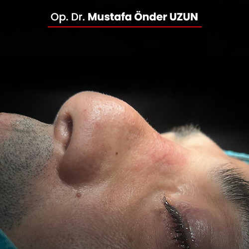 3-oncesi-01092025 3-oncesi-01092025