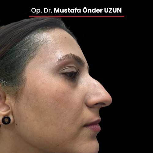 4-oncesi-01092025 4-oncesi-01092025