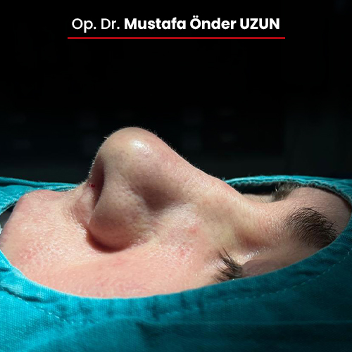 6-oncesi-01092025 6-oncesi-01092025
