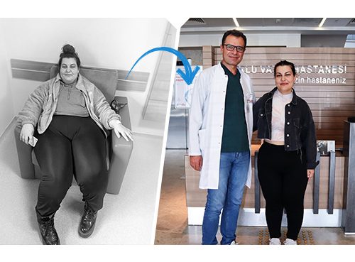 Yılan Yapısı 2120260927