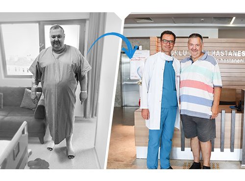 Yılan Yapısı 1563563712